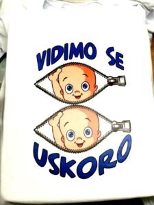 Vidimo se uskoro blizanci