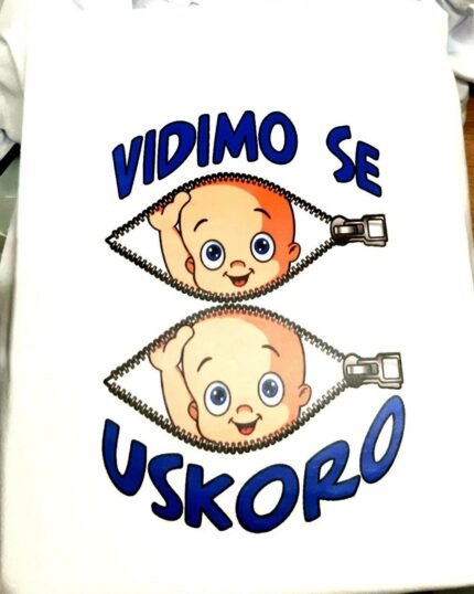 Vidimo se uskoro blizanci