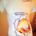 Vidimo se uskoro - nova verzija