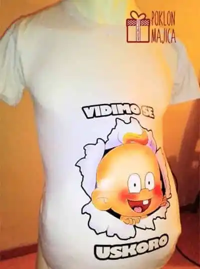 Vidimo se uskoro - nova verzija